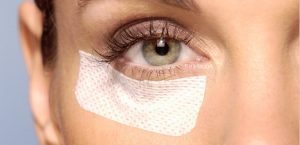 Blefaroplastia