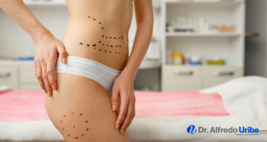 Fajas después de la abdominoplastia