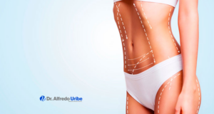 antes y después de la liposcultura