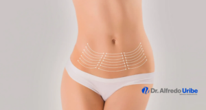 onsejos para reducir la hinchazón después de una liposucción