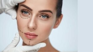 Qué debes saber sobre la mentoplastía