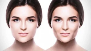 Conoce todo sobre el afinamiento facial