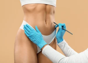 Todo sobre la lipoescultura HD