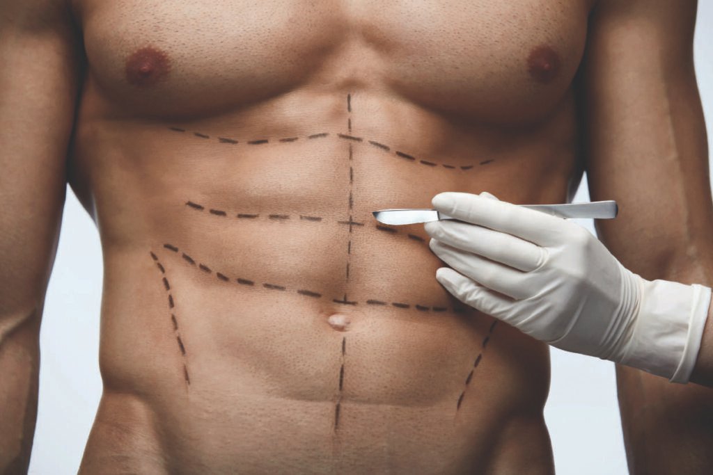 Lipoescultura para hombres