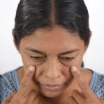 Blefaroplastía antes y después