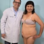 Antes y después de Abdominoplastía