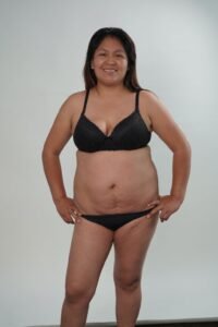 Algunos de los casos de éxito de Cirugía Estética Uribe