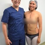 Antes y después de una liposucción