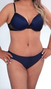 Algunos de los casos de éxito de Cirugía Estética Uribe