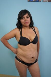 Algunos de los casos de éxito de Cirugía Estética Uribe