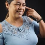 Blefaroplastía antes y después